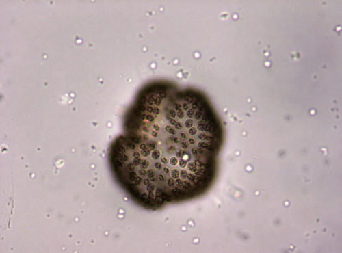 An image a phytoplankton specimen